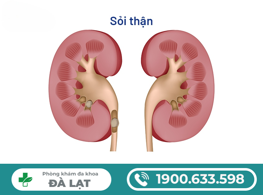 Hình ảnh minh họa